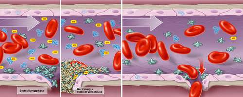 Chảy máu kéo dài - Hình ảnh minh họa